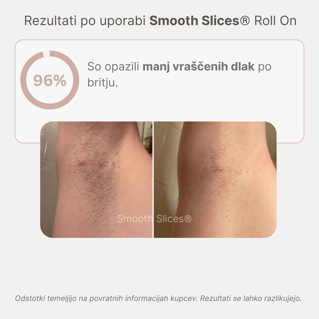 Smooth Slices® Roll-on proti vraščenim dlakam in izboklinam