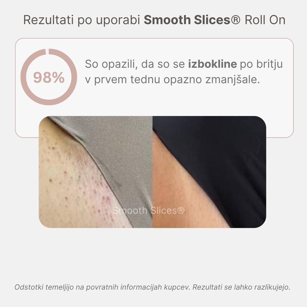 Smooth Slices® Roll-on proti vraščenim dlakam in izboklinam
