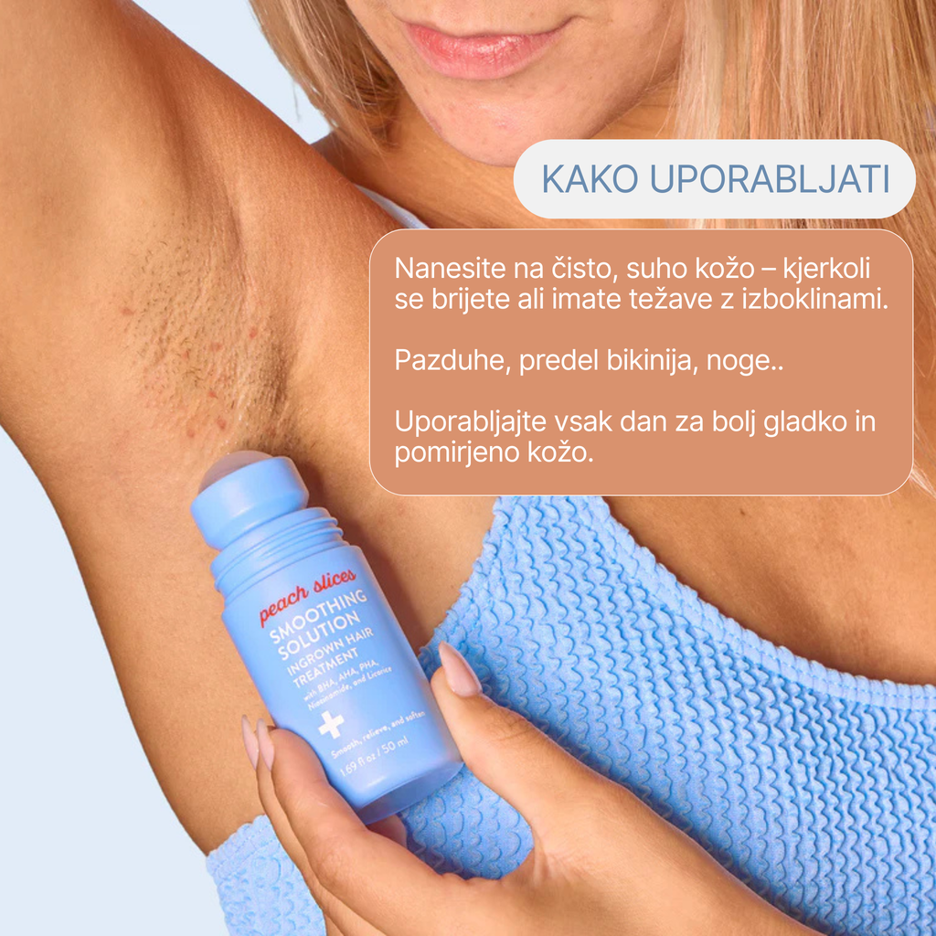 Smooth Slices® Roll-on proti vraščenim dlakam in izboklinam